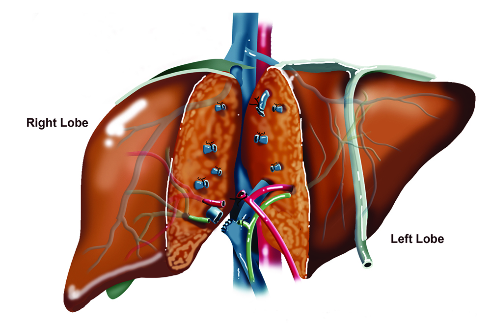 animated lungs